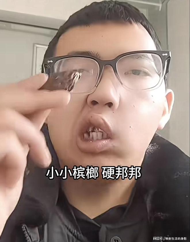 年导致脸部变形还边嚼边劝大家别碰槟榔j9九游会真人游戏第一男子嚼槟榔七(图2)